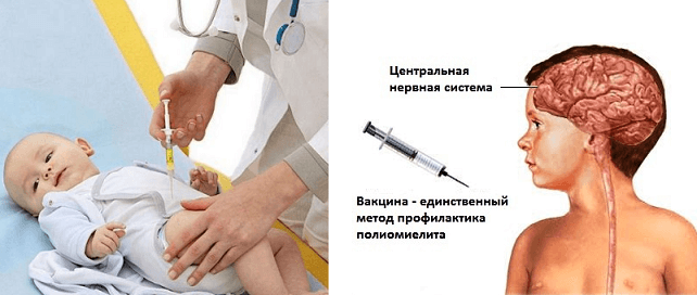 Акдс прививка осложнения. Осложнения от вакцины. Последствия от прививок. Осложнения после прививки у детей. Осложнения вакцинации у детей.